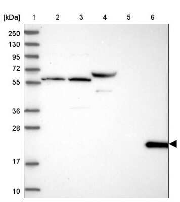 Western Blot: CD3 epsilon Antibody [NBP2-38520]