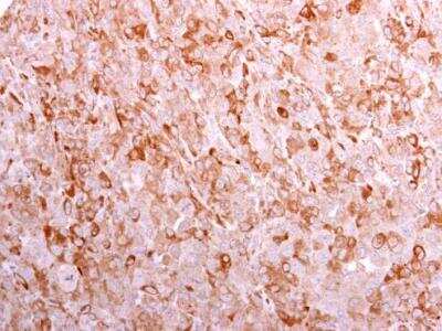 Immunohistochemistry-Paraffin: CD3 gamma Antibody [NBP1-31250]