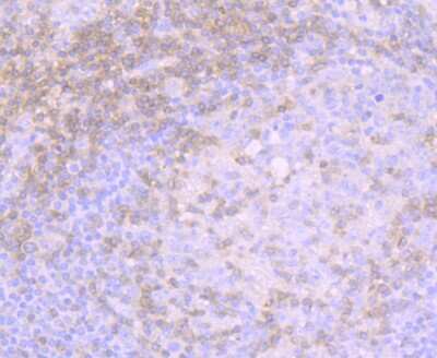 Immunohistochemistry-Paraffin: CD3 gamma Antibody (JB38-29) [NBP2-75435]