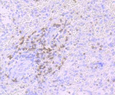 Immunohistochemistry-Paraffin: CD3 gamma Antibody (JB38-29) [NBP2-75435]