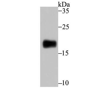 Western Blot: CD3 gamma Antibody (JB38-29) [NBP2-75435]