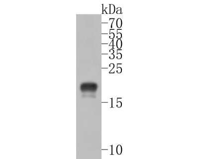 Western Blot: CD3 gamma Antibody (JB38-29) [NBP2-75435]