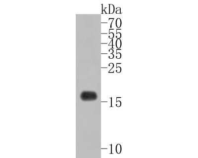 Western Blot: CD3 gamma Antibody (JB38-29) [NBP2-75435]