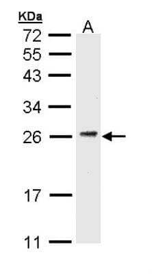 Western Blot: CD3 gamma Antibody [NBP1-31250]