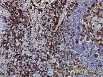 Immunohistochemistry-Paraffin: CD3 zeta Antibody (4A12-F6) [H00000919-M01]