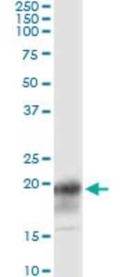 Immunoprecipitation: CD3 zeta Antibody (4A12-F6) [H00000919-M01]