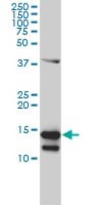 Western Blot: CD3 zeta Antibody (4A12-F6) [H00000919-M01]