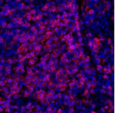 Immunohistochemistry: CD3 zeta Antibody (BL-336-1B2) [NBP2-76399]