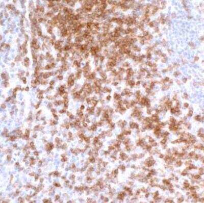 Immunohistochemistry-Paraffin: CD3 zeta Antibody (BL-336-1B2) [NBP2-76399]