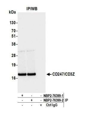 Immunoprecipitation: CD3 zeta Antibody (BL-336-1B2) [NBP2-76399]