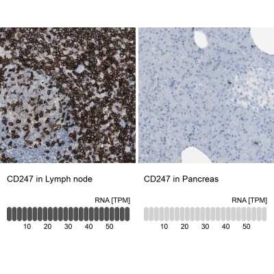 Immunohistochemistry-Paraffin: CD3 zeta Antibody [NBP1-85750]