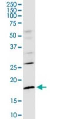 Western Blot: CD3 zeta Antibody [H00000919-D01P]
