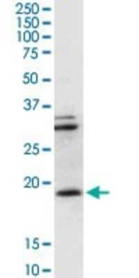 Western Blot: CD3 zeta Antibody [H00000919-D01P]