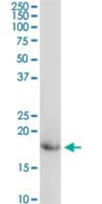 Western Blot: CD3 zeta Antibody [H00000919-D01P]