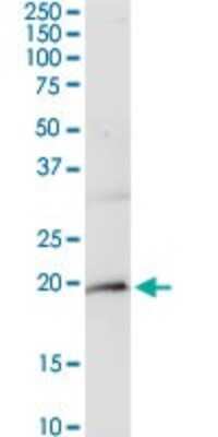 Western Blot: CD3 zeta Antibody [H00000919-D01P]