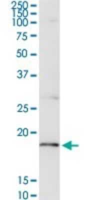 Western Blot: CD3 zeta Antibody [H00000919-D01P]