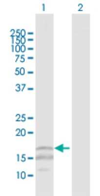 Western Blot: CD3 zeta Antibody [H00000919-D01P]