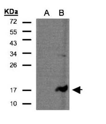 Western Blot: CD3 zeta Antibody [NBP2-15796]