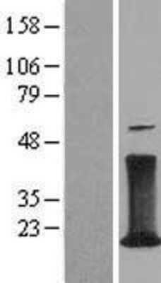 Western Blot: CD3 zeta Overexpression Lysate [NBL1-08925]