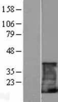 Western Blot: CD3 zeta Overexpression Lysate [NBP2-10689]