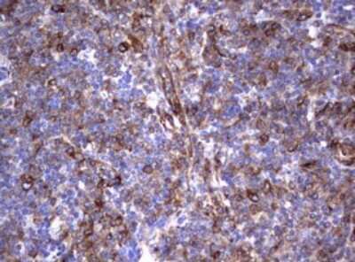 Immunohistochemistry: CD30/TNFRSF8 Antibody (OTI1C6) [NBP2-46157]