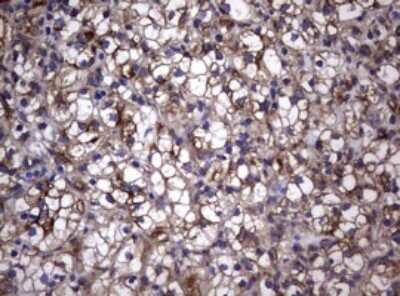 Immunohistochemistry: CD30/TNFRSF8 Antibody (OTI1C6) [NBP2-46157]