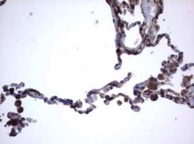Immunohistochemistry: CD30/TNFRSF8 Antibody (OTI1C6) [NBP2-46157]
