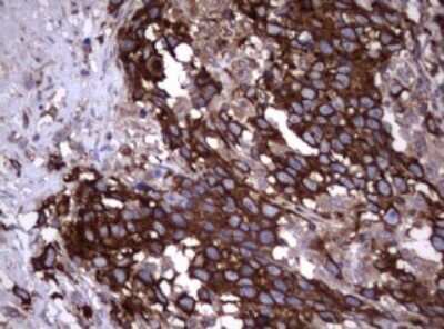 Immunohistochemistry: CD30/TNFRSF8 Antibody (OTI1C6) [NBP2-46157]