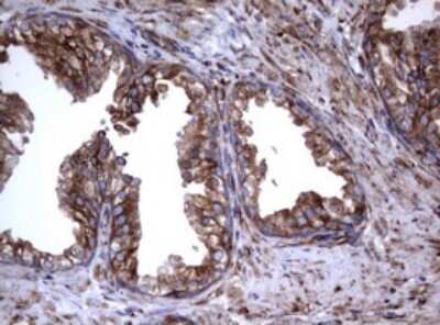 Immunohistochemistry: CD30/TNFRSF8 Antibody (OTI1C6) [NBP2-46157]