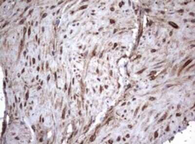 Immunohistochemistry: CD30/TNFRSF8 Antibody (OTI1C6) [NBP2-46157]