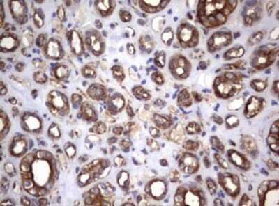 Immunohistochemistry: CD30/TNFRSF8 Antibody (OTI1C6) [NBP2-46157]