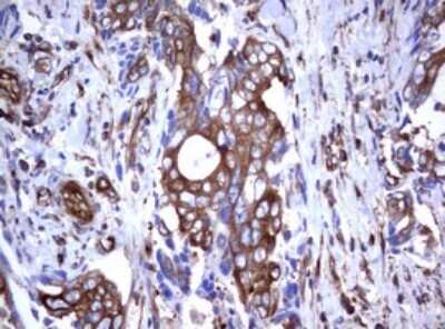 Immunohistochemistry: CD30/TNFRSF8 Antibody (OTI1C6) [NBP2-46157]