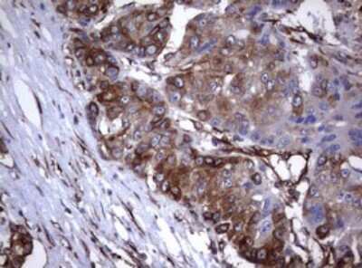 Immunohistochemistry: CD30/TNFRSF8 Antibody (OTI1C6) [NBP2-46157]