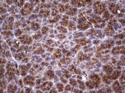 Immunohistochemistry: CD30/TNFRSF8 Antibody (OTI1C6) [NBP2-46157]