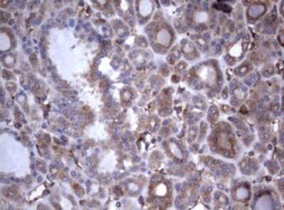 Immunohistochemistry: CD30/TNFRSF8 Antibody (OTI1C6) [NBP2-46157]