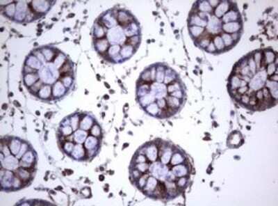 Immunohistochemistry: CD30/TNFRSF8 Antibody (OTI1C6) [NBP2-46157]
