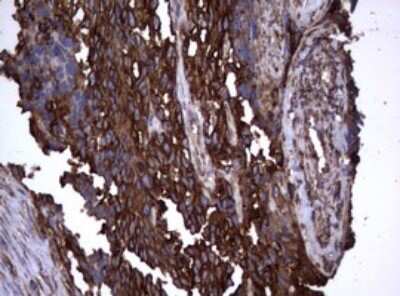 Immunohistochemistry: CD30/TNFRSF8 Antibody (OTI1C6) [NBP2-46157]