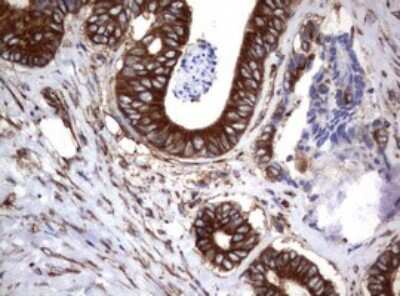 Immunohistochemistry: CD30/TNFRSF8 Antibody (OTI1C6) [NBP2-46157]
