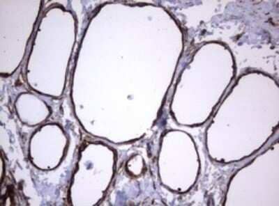 Immunohistochemistry: CD30/TNFRSF8 Antibody (OTI1C6) [NBP2-46157]