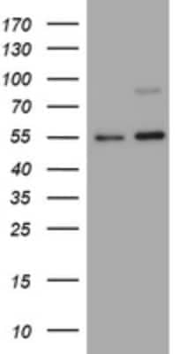 Western Blot: CD30/TNFRSF8 Antibody (OTI1C6) [NBP2-46157]