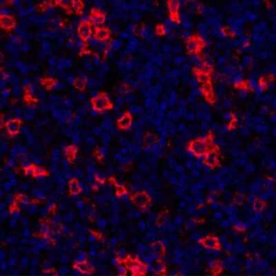 Immunocytochemistry/ Immunofluorescence: CD30/TNFRSF8 Antibody (BLR055F) [NBP2-76365]