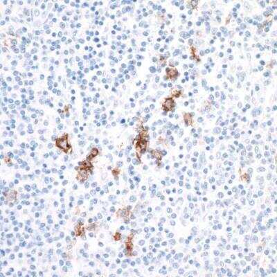 Immunohistochemistry: CD30/TNFRSF8 Antibody (BLR055F) [NBP2-76365]