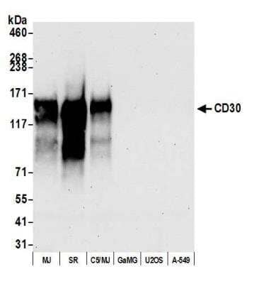 Western Blot: CD30/TNFRSF8 Antibody (BLR055F) [NBP2-76365]