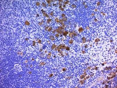 Immunohistochemistry-Paraffin: CD30/TNFRSF8 Antibody (Ber-H2 + CD30/412) [NBP2-44563]