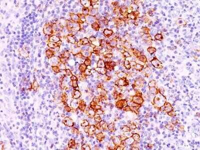 Immunohistochemistry-Paraffin: CD30/TNFRSF8 Antibody (CD30/412) - Azide and BSA Free [NBP2-33196]