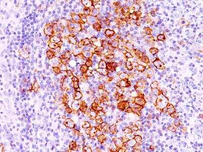 Immunohistochemistry-Paraffin: CD30/TNFRSF8 Antibody (CD30/412) [NBP2-29425]