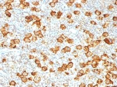 Immunohistochemistry-Paraffin: CD30/TNFRSF8 Antibody (Ki-1/1505R) [NBP2-53309]