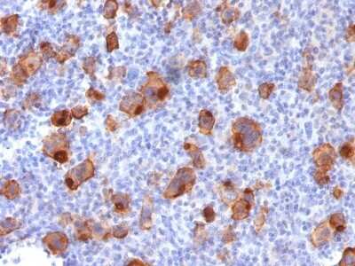 Immunohistochemistry-Paraffin: CD30/TNFRSF8 Antibody (Ki-1/1747R) [NBP2-53310]