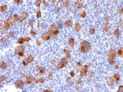 Immunohistochemistry-Paraffin: CD30/TNFRSF8 Antibody (Ki-1/1747R) - Azide and BSA Free [NBP2-54556]