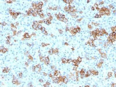 Immunohistochemistry-Paraffin: CD30/TNFRSF8 Antibody (Ki-1/779) - Azide and BSA Free [NBP2-47906]